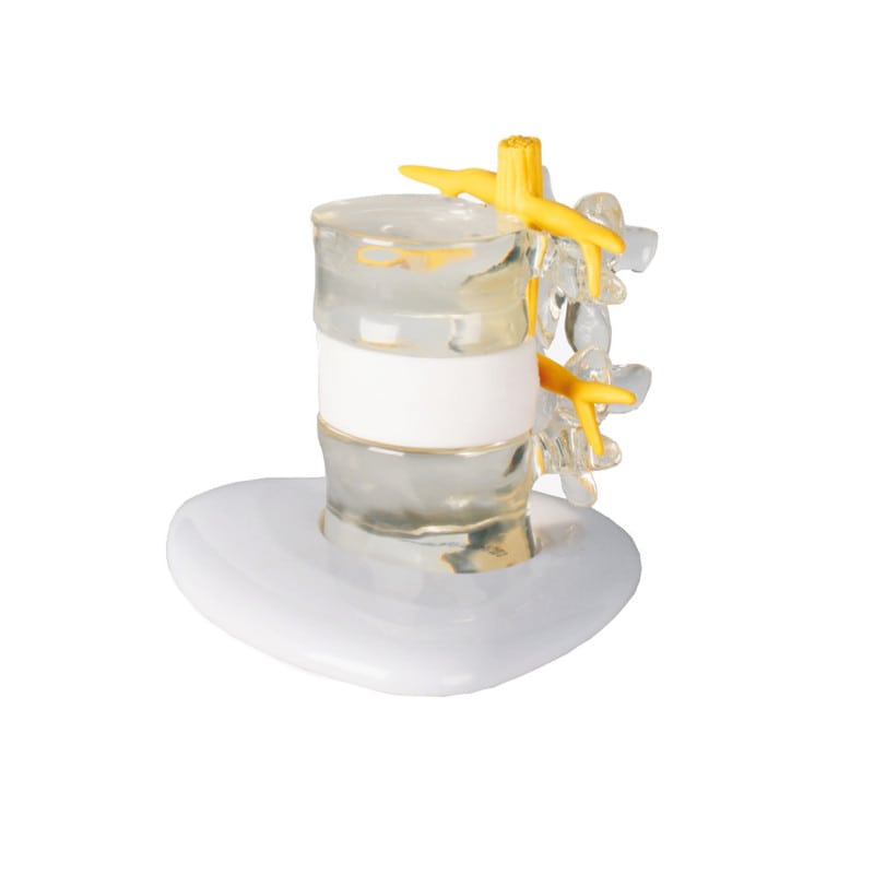 Herniated Disc Simulator Medvana UK