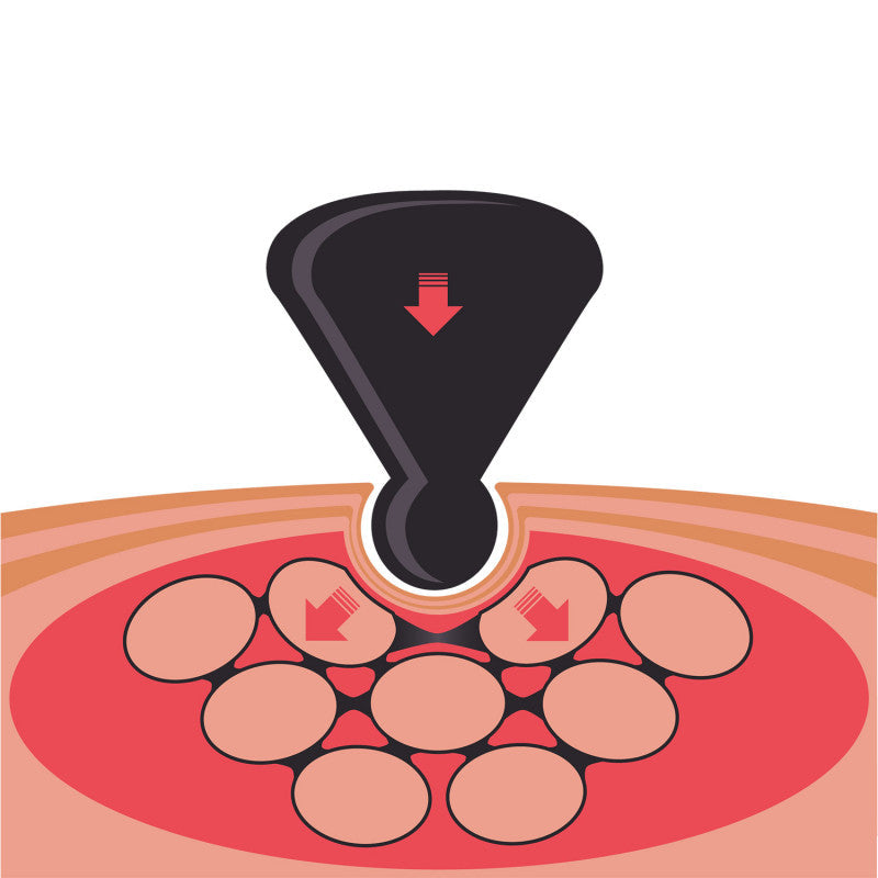 TMX® TRIGGER ORIGINAL Medvana UK