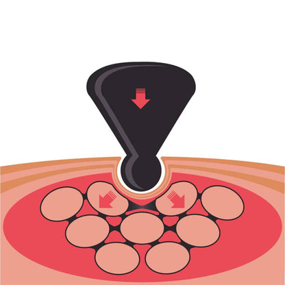 TMX® TRIGGER ORIGINAL PLUS brown Medvana UK