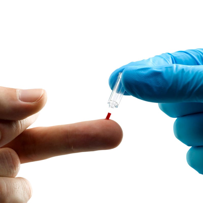 Quo-Test® HbA1c Analyser Medvana UK