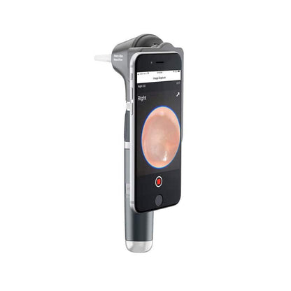 MacroView Plus Otoscope for iExaminer