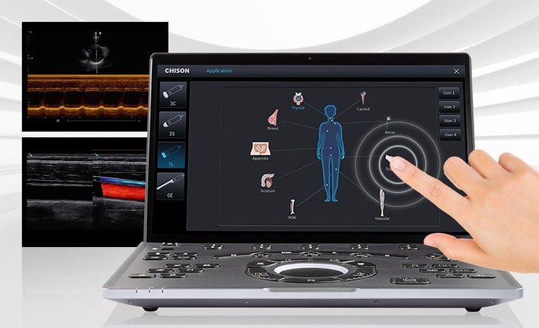 Chison SonoAir 70 Ultrasound System Medvana UK