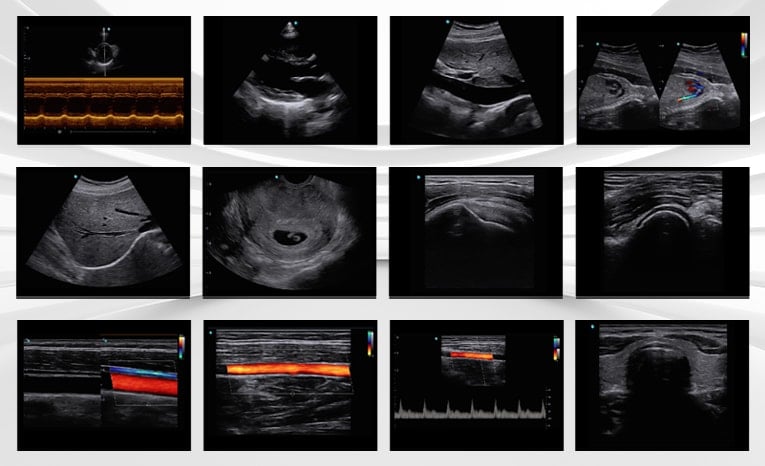 Chison SonoAir 70 Ultrasound System Medvana UK