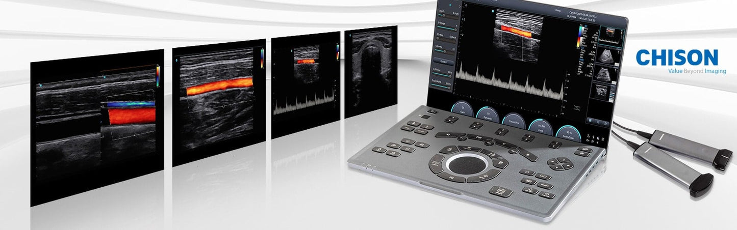 Chison SonoAir 70 Ultrasound System Medvana UK
