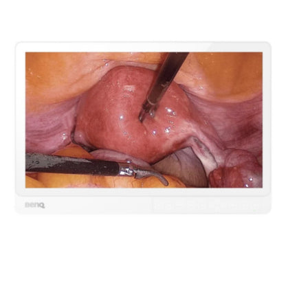 BenQ 21.5" Full HD Surgical Display Medvana UK