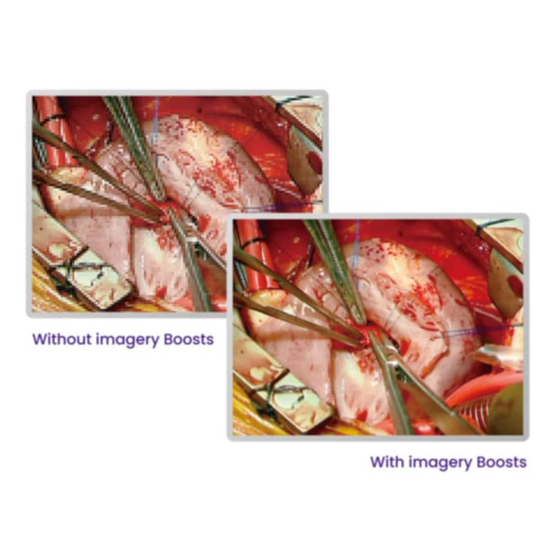 BenQ 27" High-Bright Full-HD Surgical Display Medvana UK
