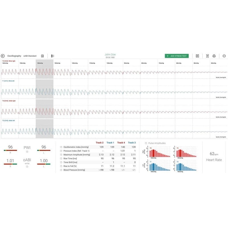 AngE™ ABI+ with TBI Add-On Medvana UK