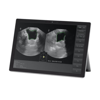 Vitascan LT Bladder Scanner with Microsoft Surface Tablet