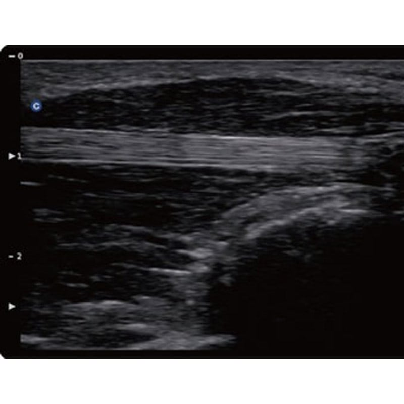 QBit 5 Ultrasound Machine without battery Medvana UK