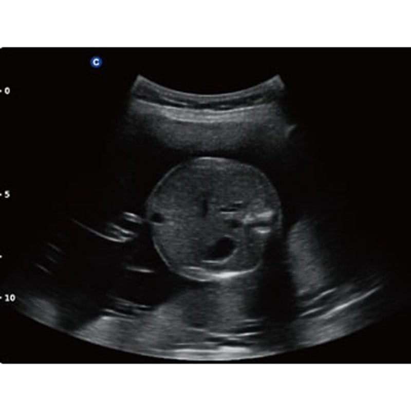 QBit 5 Ultrasound Machine with battery Medvana UK