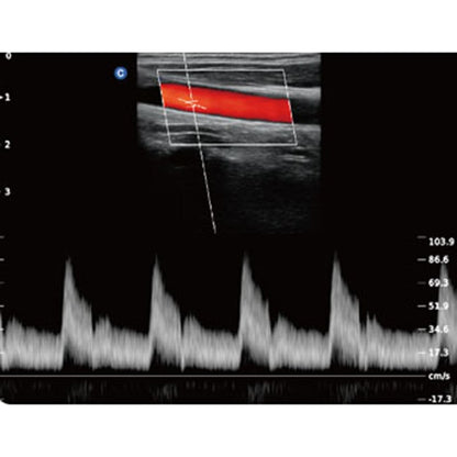 QBit 5 Ultrasound Machine with battery Medvana UK