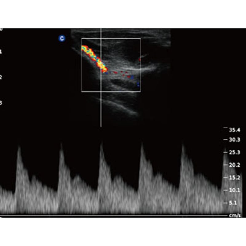 QBit 5 Ultrasound Machine with battery Medvana UK