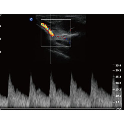 QBit 5 Ultrasound Machine with battery Medvana UK