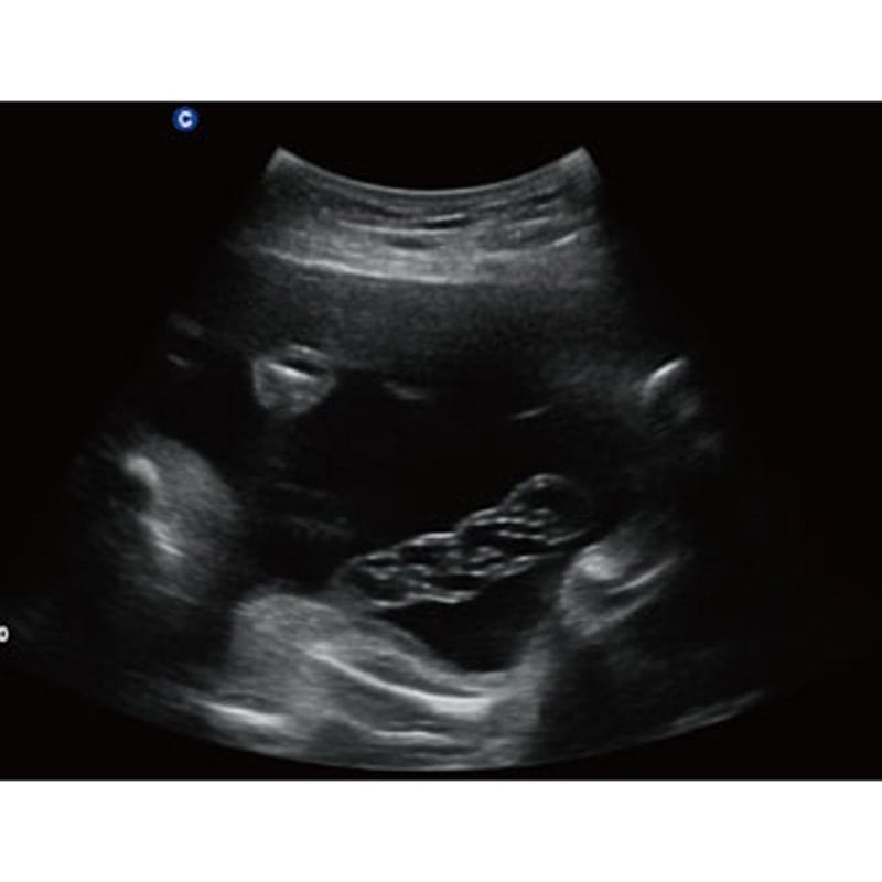 QBit 5 Ultrasound Machine without battery Medvana UK