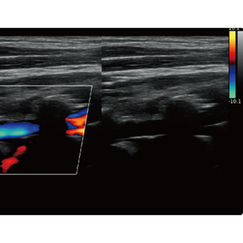 QBit 5 Ultrasound Machine with battery Medvana UK