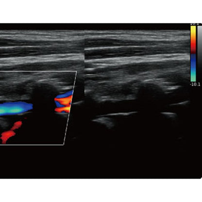 QBit 5 Ultrasound Machine without battery Medvana UK