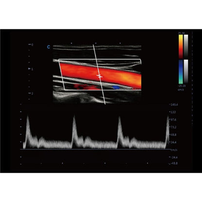 CBit 9 Color Doppler Ultrasound System with battery Medvana UK