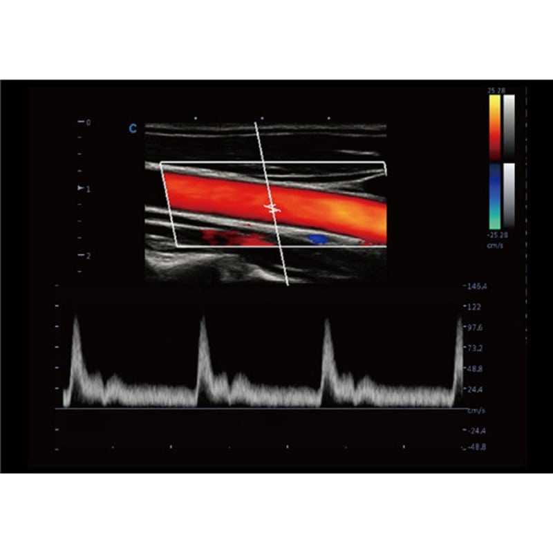 CBit 9 Color Doppler Ultrasound System without battery Medvana UK
