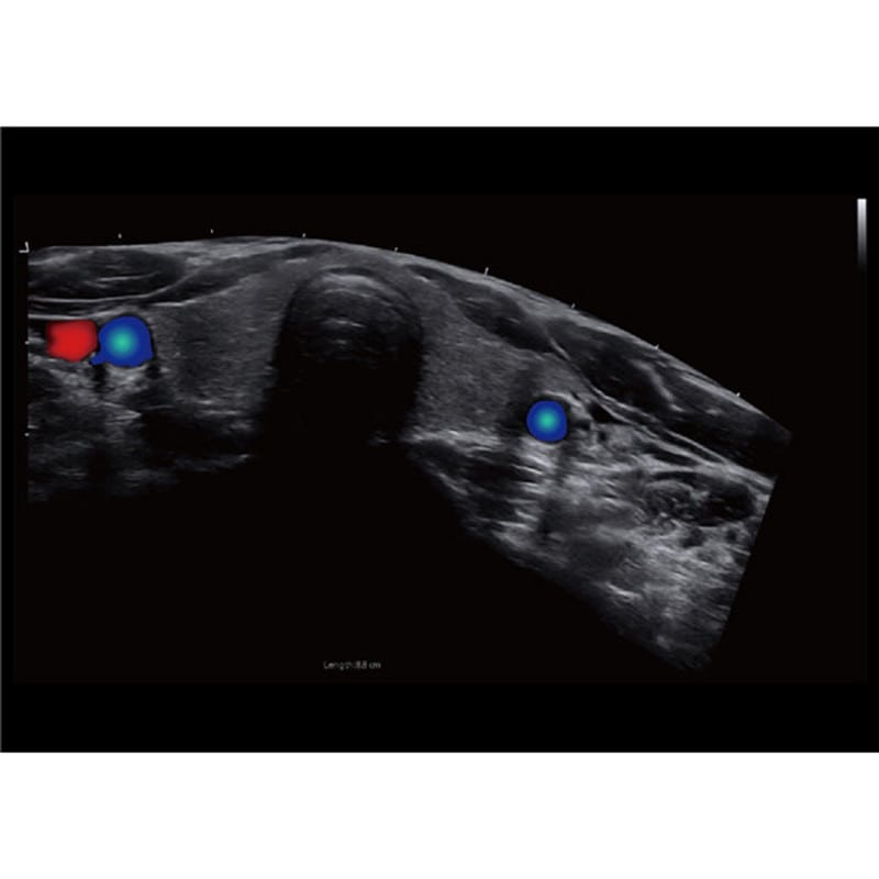 CBit 9 Color Doppler Ultrasound System with battery Medvana UK