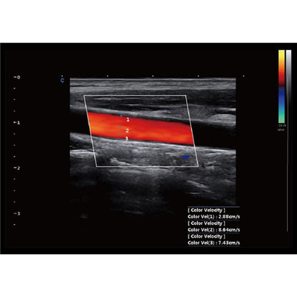 CBit 9 Color Doppler Ultrasound System with battery Medvana UK