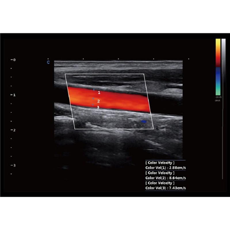 CBit 9 Color Doppler Ultrasound System without battery Medvana UK
