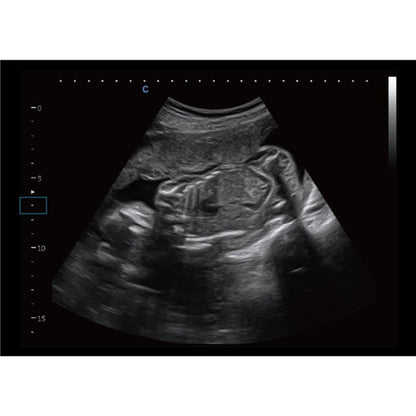 CBit 9 Color Doppler Ultrasound System without battery Medvana UK