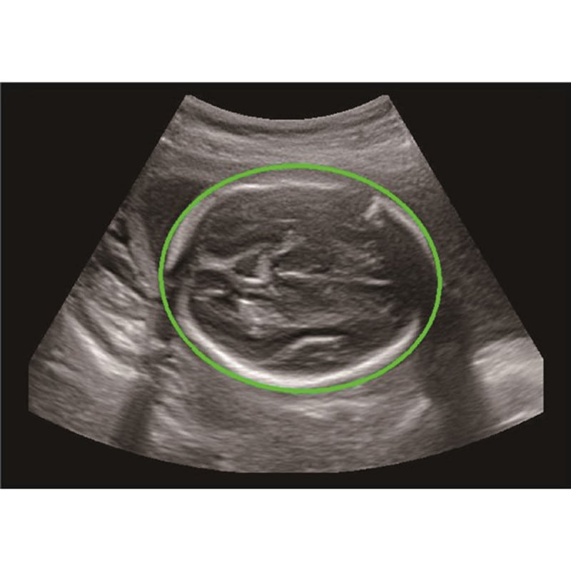 CBit 9 Color Doppler Ultrasound System with battery Medvana UK