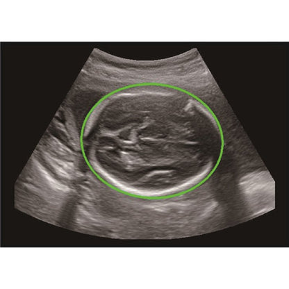 CBit 9 Color Doppler Ultrasound System with battery Medvana UK