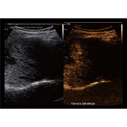 CBit 9 Color Doppler Ultrasound System with battery Medvana UK