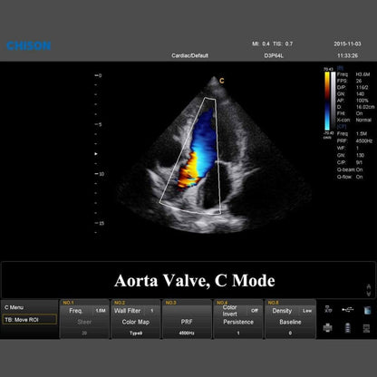 QBit 7 Ultrasound System Medvana UK