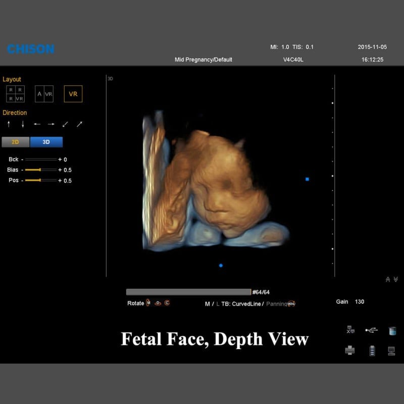 QBit 7 Ultrasound System Medvana UK