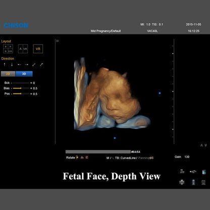 QBit 7 Ultrasound System Medvana UK