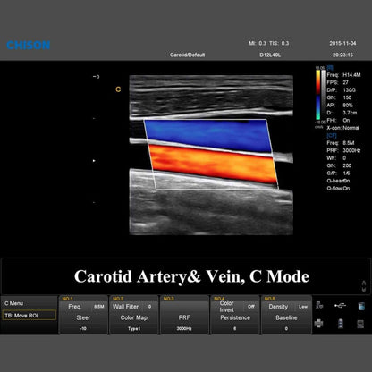 QBit 7 Ultrasound System Medvana UK