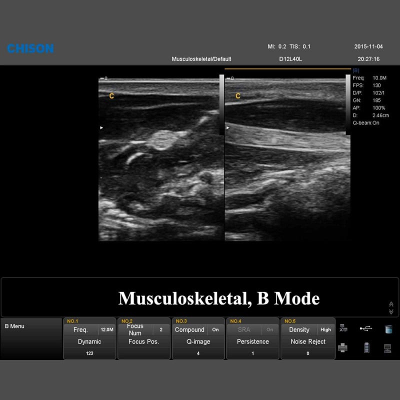 QBit 7 Ultrasound System Medvana UK