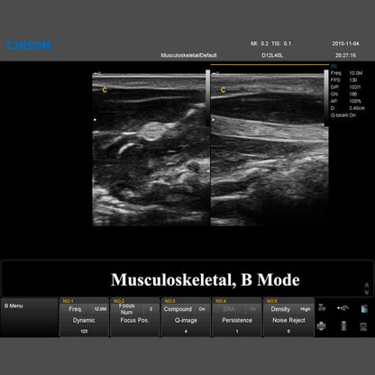 QBit 7 Ultrasound System Medvana UK