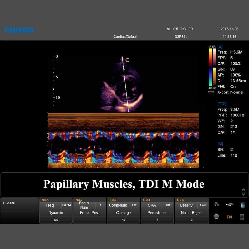 QBit 7 Ultrasound System Medvana UK
