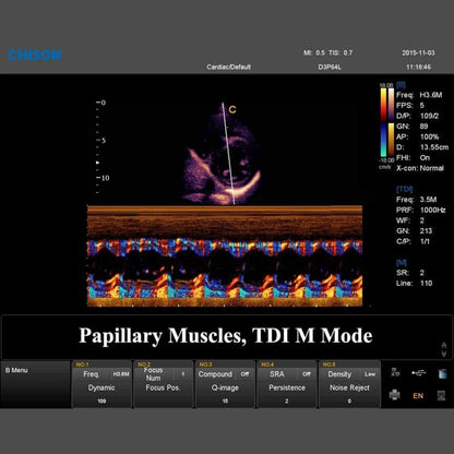 QBit 7 Ultrasound System Medvana UK