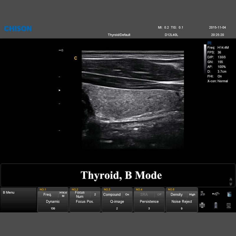 QBit 7 Ultrasound System Medvana UK