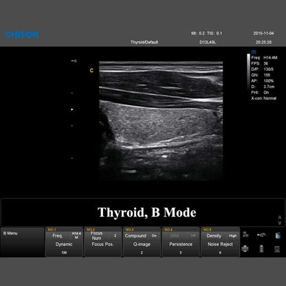 QBit 7 Ultrasound System Medvana UK