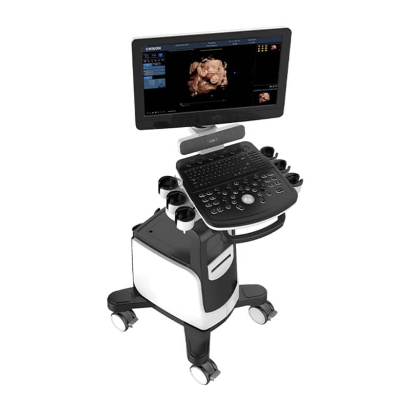 QBit 7 Ultrasound System Medvana UK