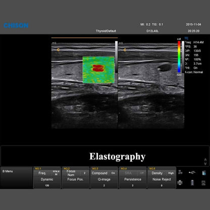 QBit 9 Ultrasound System Medvana UK