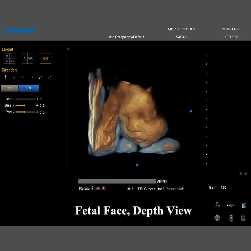 QBit 9 Ultrasound System Medvana UK