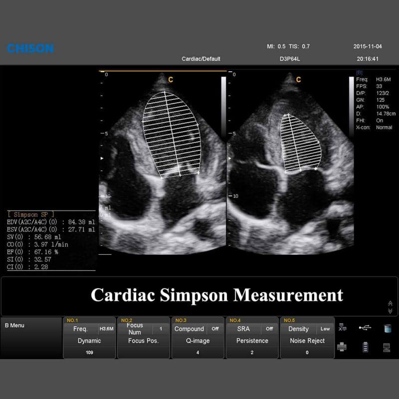 QBit 9 Ultrasound System Medvana UK