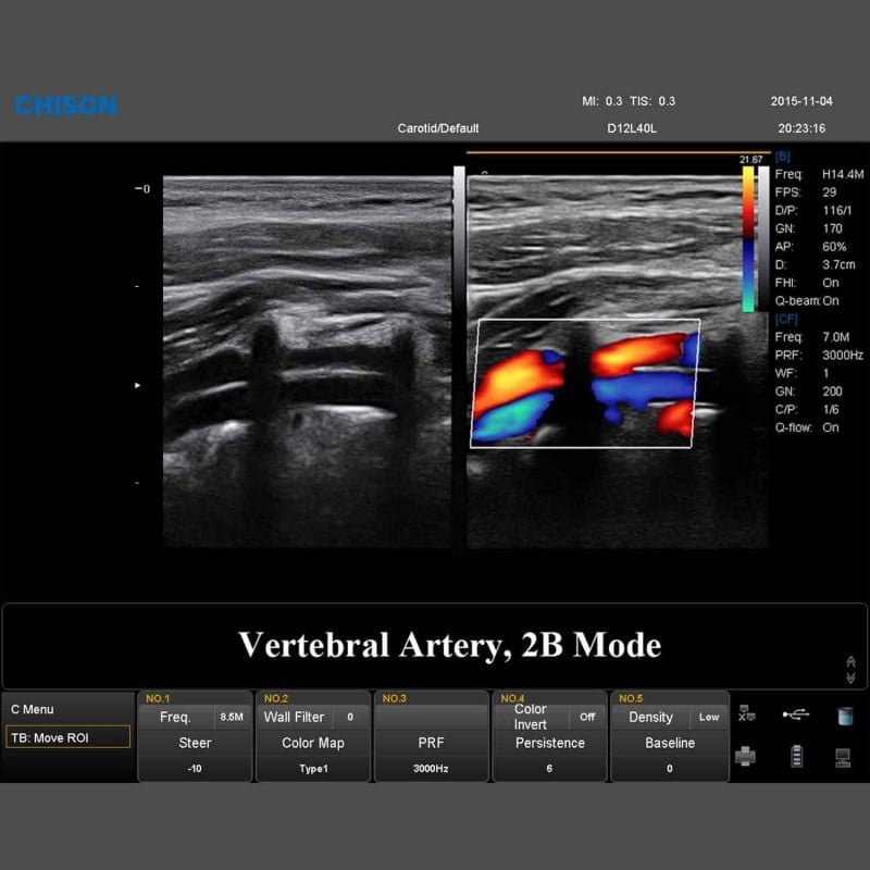 QBit 9 Ultrasound System Medvana UK