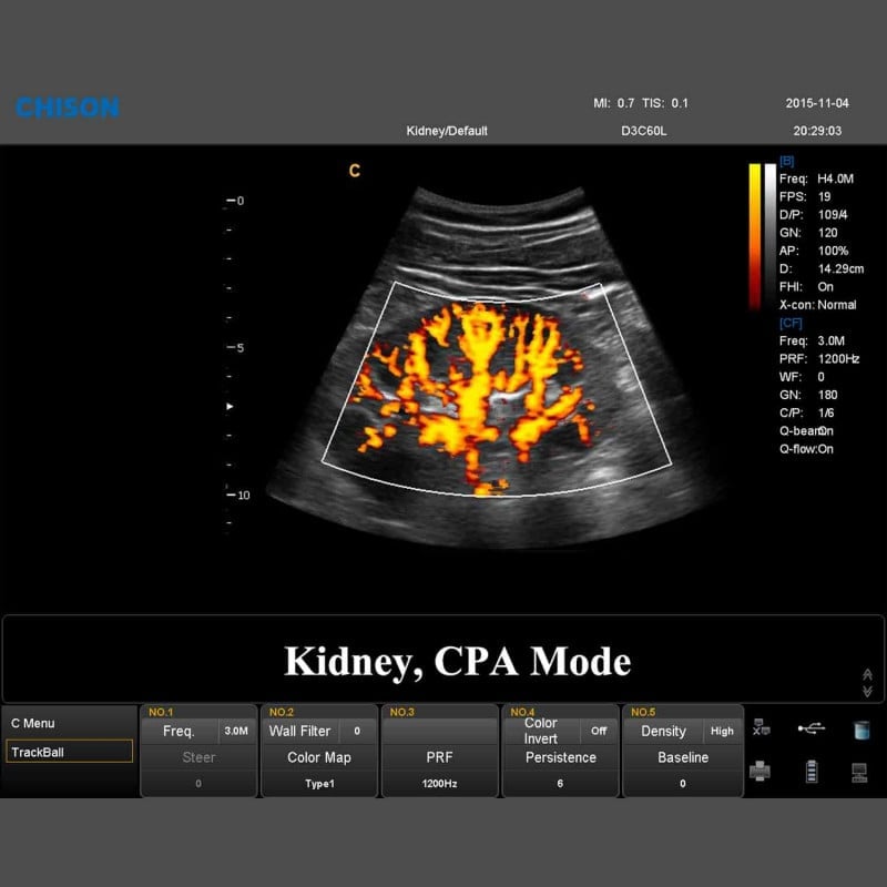 QBit 9 Ultrasound System Medvana UK
