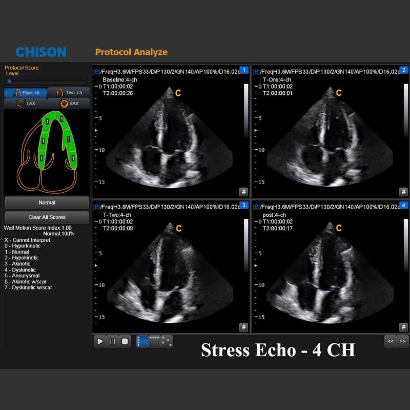 QBit 9 Ultrasound System Medvana UK