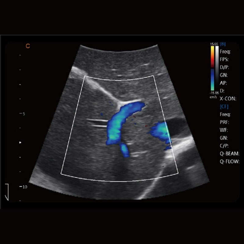 CBit 4 Ultrasound System Medvana UK