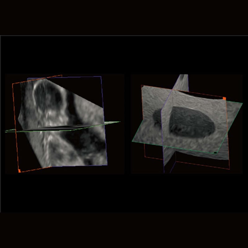 CBit 4 Ultrasound System Medvana UK