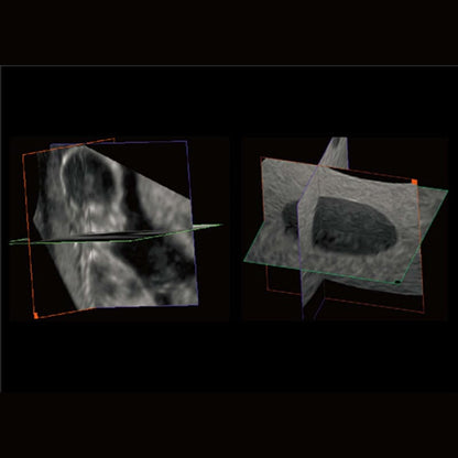 CBit 4 Ultrasound System Medvana UK