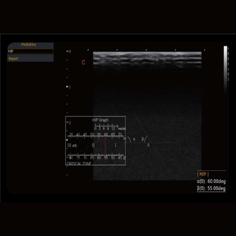 CBit 4 Ultrasound System Medvana UK